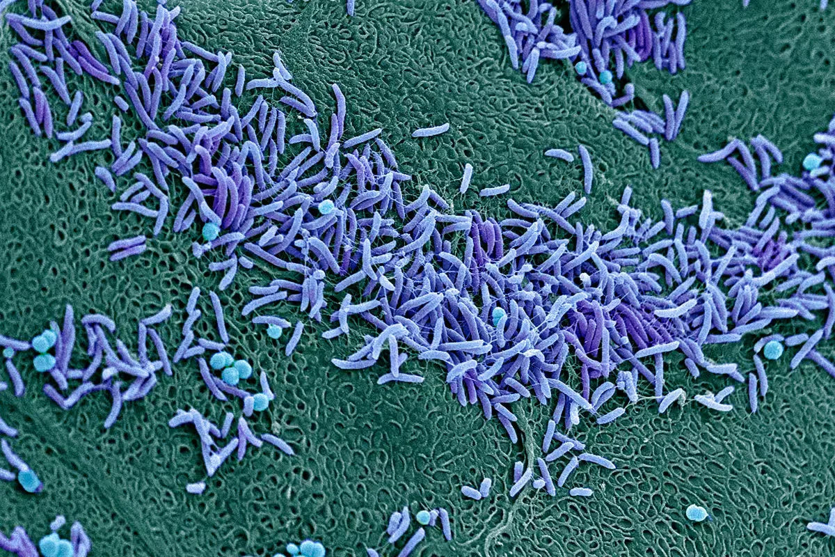 ¿Qué es el microbioma vaginal?