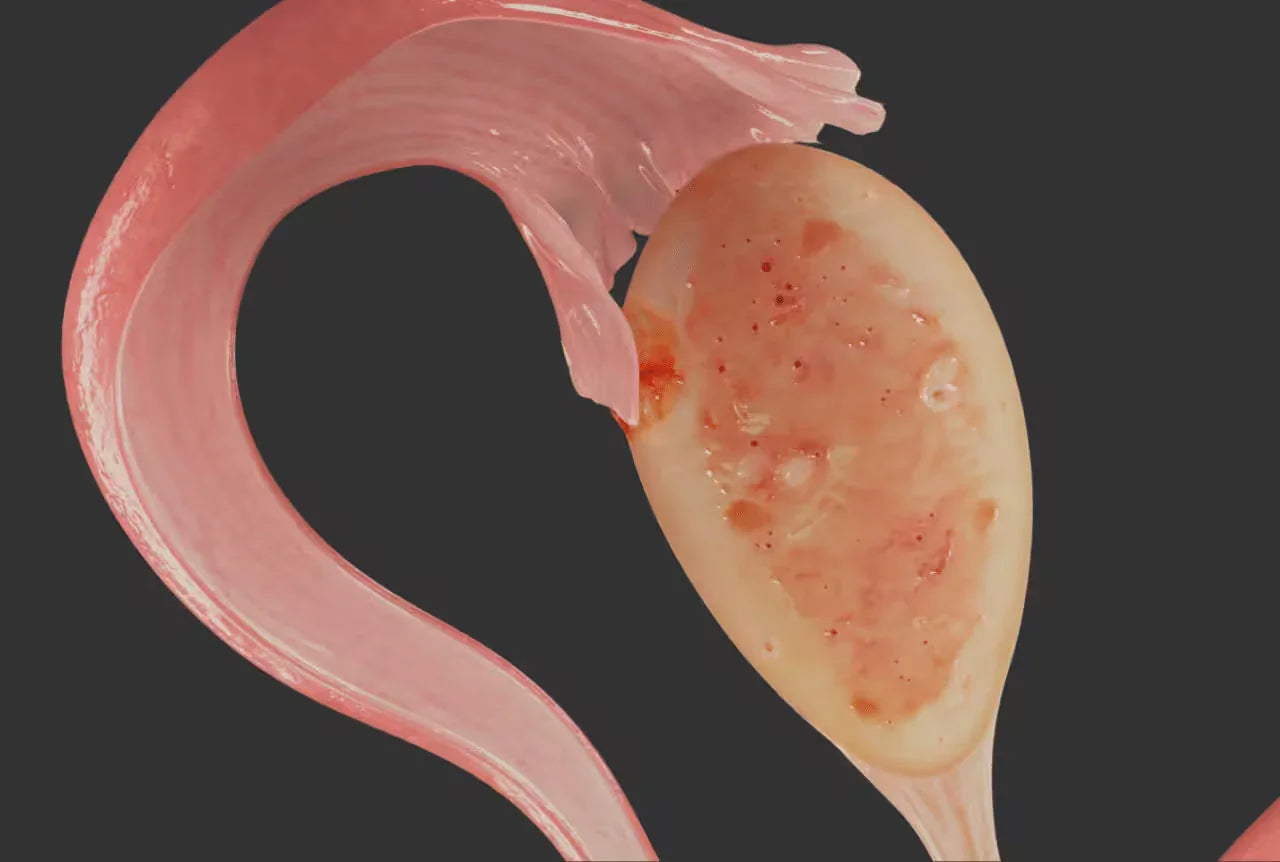 Microbioma Vaginal y Fertilidad